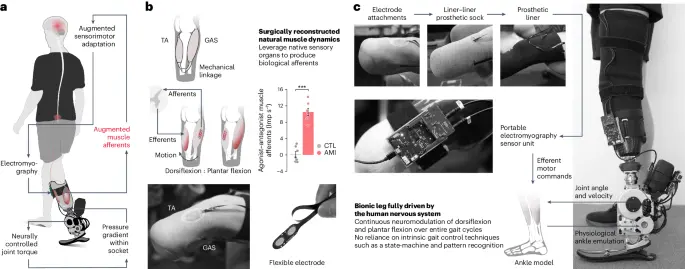 Continuous neural control of a bionic limb restores biomimetic gait after amputation - Nature Medicine