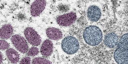 2022 Mpox Outbreak Global Map | Mpox | Poxvirus | CDC