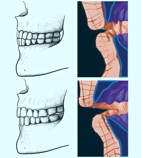 Post-Neolithic Diet-Induced Dental Changes Led to Introduction of ‘F’ and ‘V’ Sounds | Sci.News