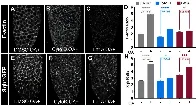 The mechanics of ovulation: Study explains how muscle-like fibers help eggs squeeze out from follicle