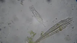Rotifer under the microscope