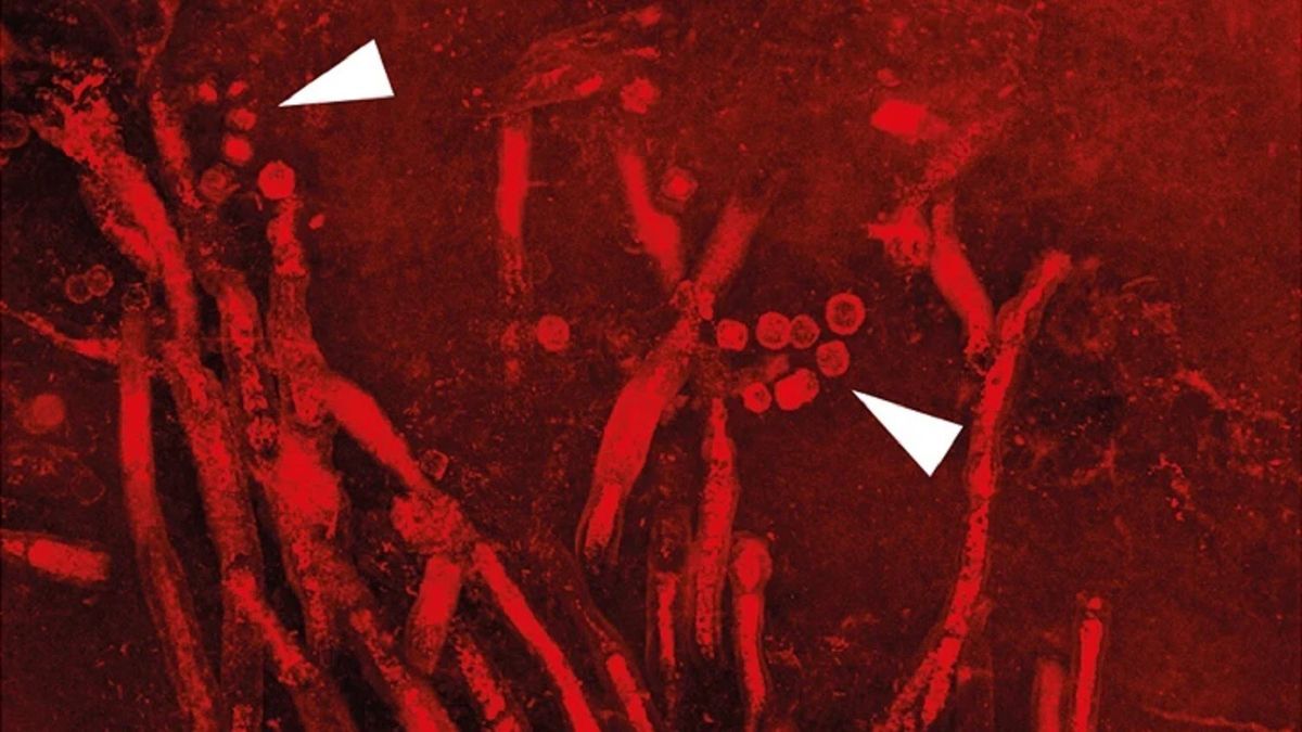 Earliest known parasitic fungus discovered in fossilized plant frozen in time 400 million years ago